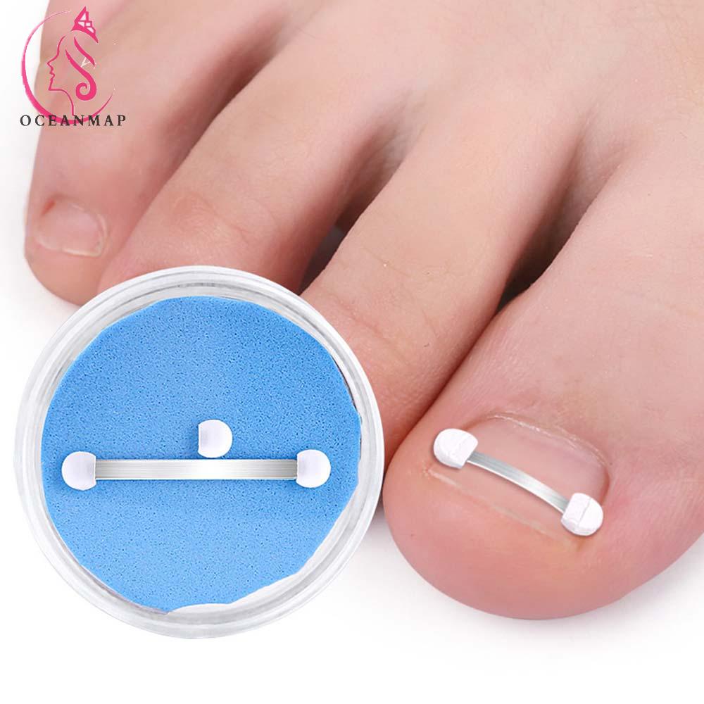 OCEANMAP Dụng Cụ Nẹp Chỉnh Hình Móng Chân Mọc Ngược Bằng Thép Không Gỉ Chuyên Nghiệp