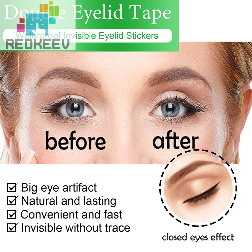 Bộ 396 Miếng Dán Kích Mí Với 3 Hình Dạng Khác Nhau