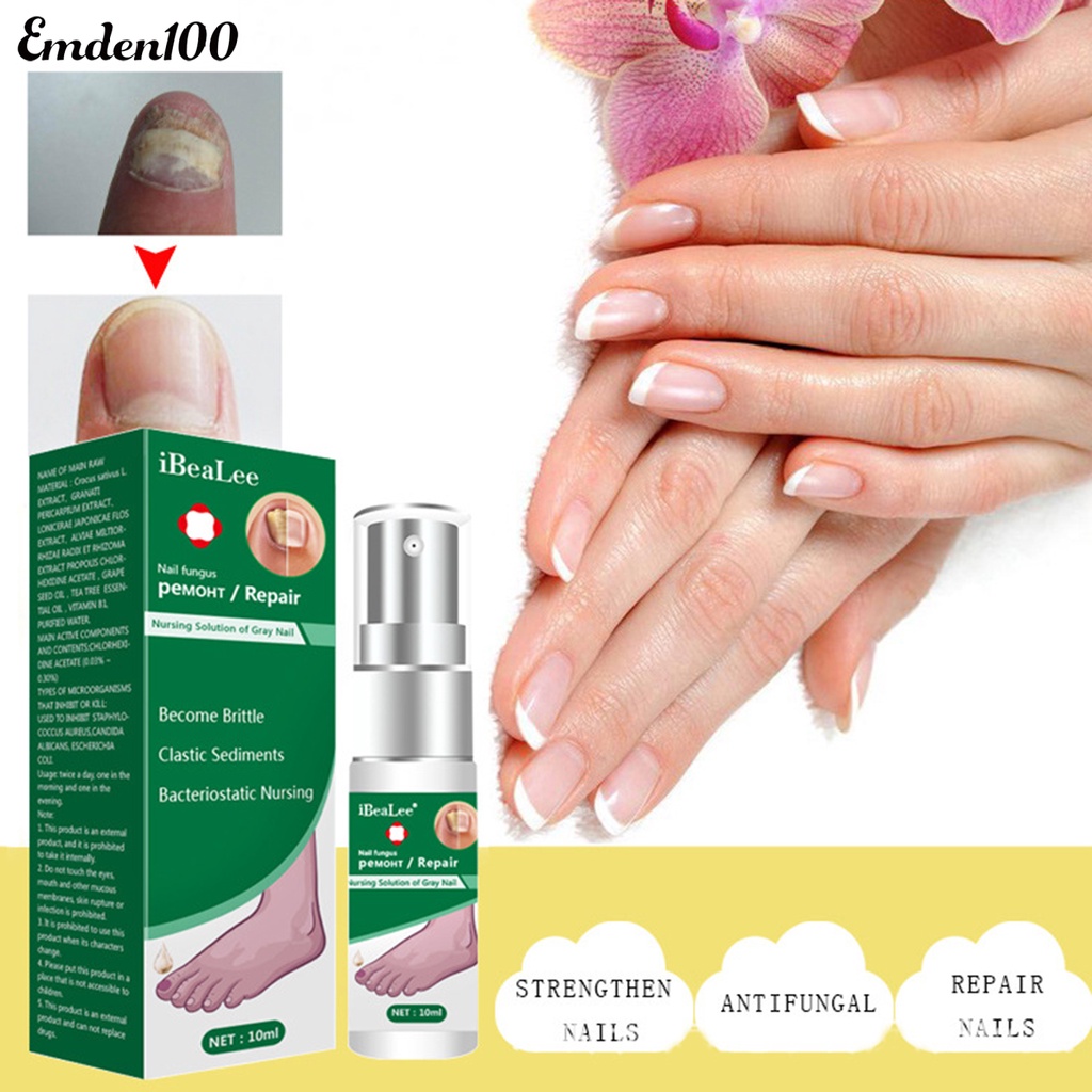 Dung Dịch Kháng Khuẩn 10ml Dễ Sử Dụng Cho Chăm Sóc Móng Tại Nhà