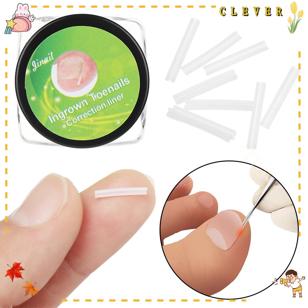 Dụng Cụ Chỉnh Hình Móng Tay Làm Đẹp Và Chăm Sóc Sức Khỏe