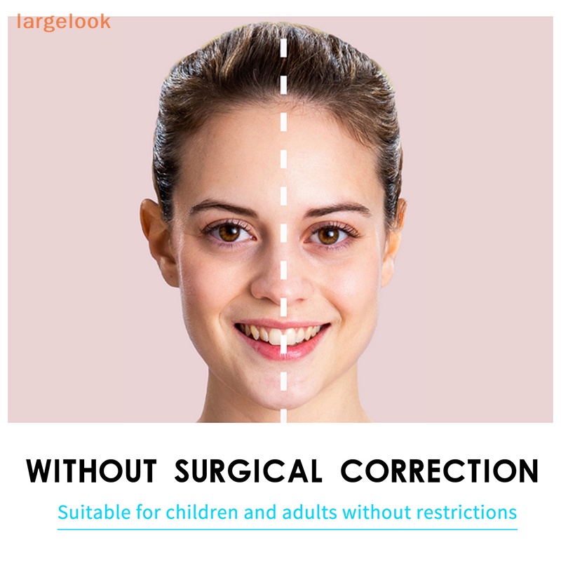 [Biglook] Set 6 Miếng Dán Định Hình Tai Chữ V Chỉnh Sửa Lỗ Tai