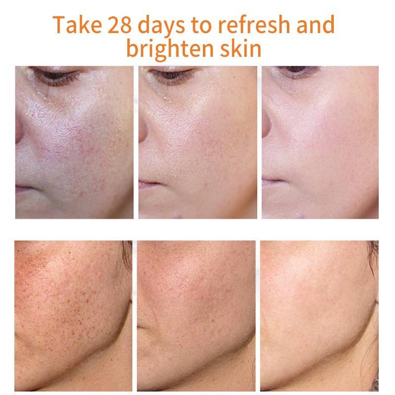 Kem Trị Nám Tẩy Collagen Nhật Bản Tẩy Gốc & Tàn Nhang Kem Tẩy Tàn Nhang Mặt 20G Vết Thâm Tẩy Trang AubessDS