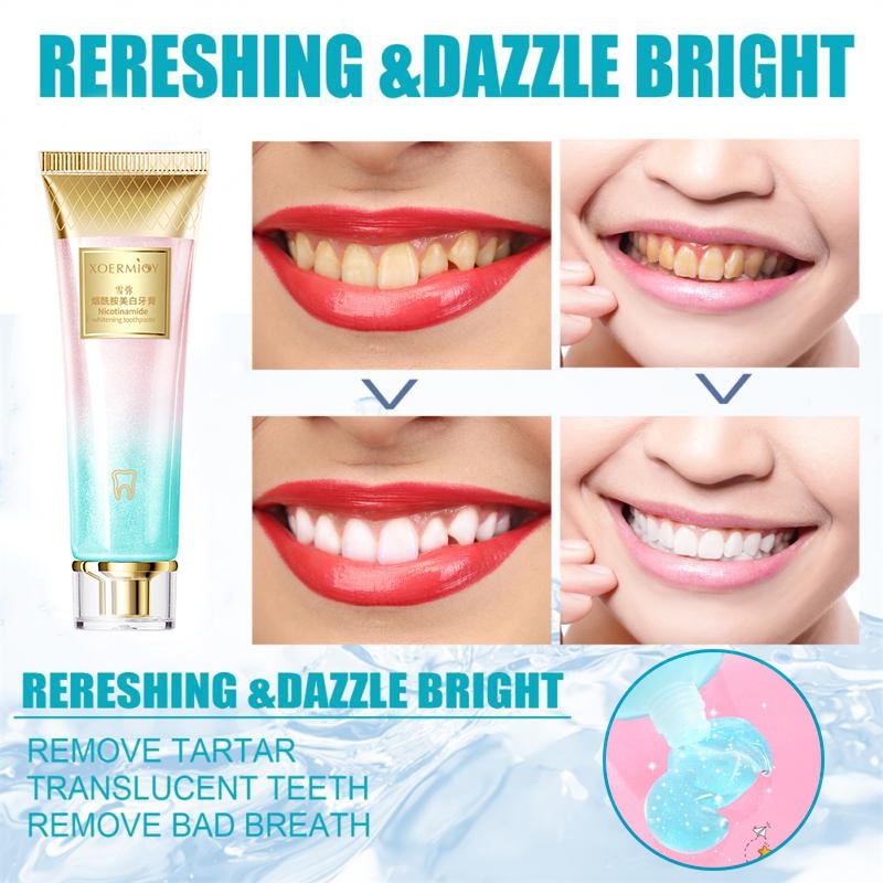 Kem Đánh Răng Làm Trắng Răng Loại Bỏ Ngứa Và Làm Trắng Răng
