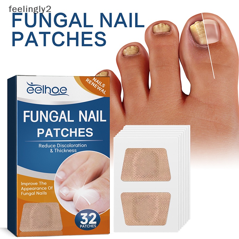 Bộ 32 Miếng Dán Chỉnh Sửa Chữa Móng Chân An Toàn