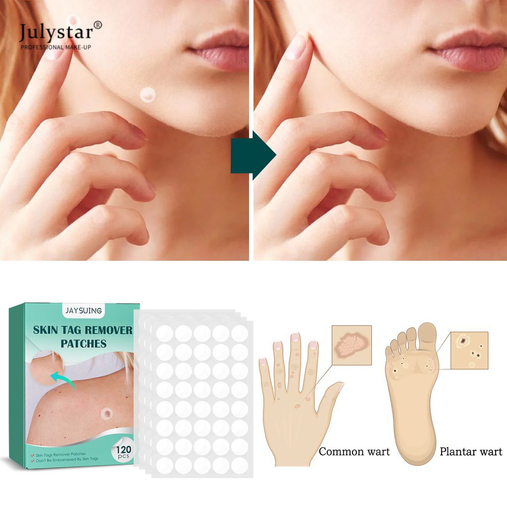 Skin Tag Remover Patches Loại bỏ mụn cóc ở chân Ngô Mụn cóc Miếng dán điều trị chiết xuất thảo dược tự nhiên Miếng dán chăm sóc cơ thể 12 cái/1 hộp JULYSTAR