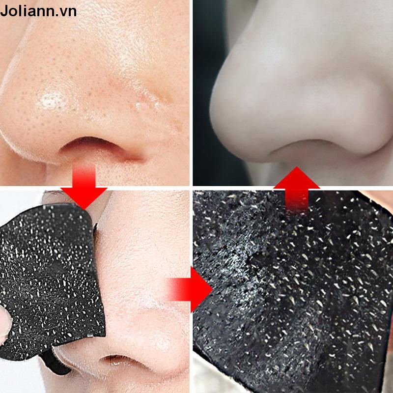 🎐Joliann🎐Miếng dán lột mụn làm sạch sâu giảm mụn đầu đen cho vùng mũi