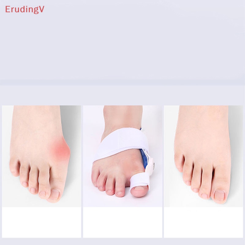 Nẹp Nẹp Chỉnh Hình Ngón Chân Giảm Đau