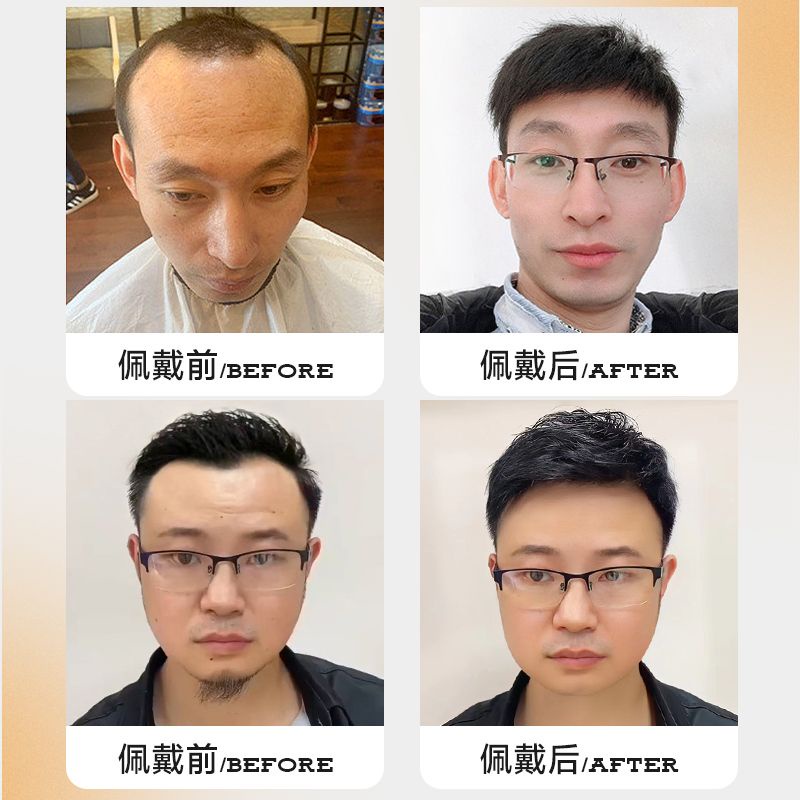Miếng Dán Giả Tóc Mái Ngang Trán Tự Nhiên Không Đường May Thoáng Khí Cho Nam