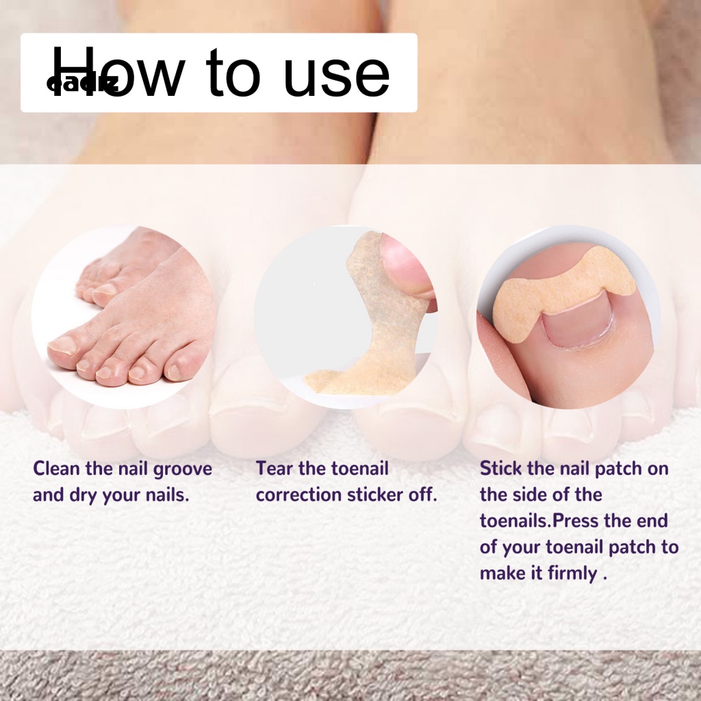 Bộ 50 Miếng Dán Móng Chân Thoáng Khí Hình Bướm Cho Nam