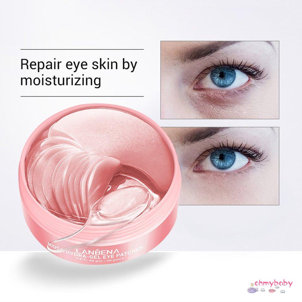 [InStock] Mặt Nạ Mắt Lanbenas Lady Rose Lb5378S Xóa Nếp Nhăn Làm Mịn Sửa Chữa Da Điều Trị Bọng Chống Lão Hóa [Z/13]