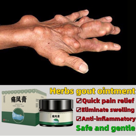 Bán Chạy#痛.Thuốc Mỡ Gió Pha Lê Giảm Đau Cho Ngón Tay / Đầu Gối / Vai 7.10L