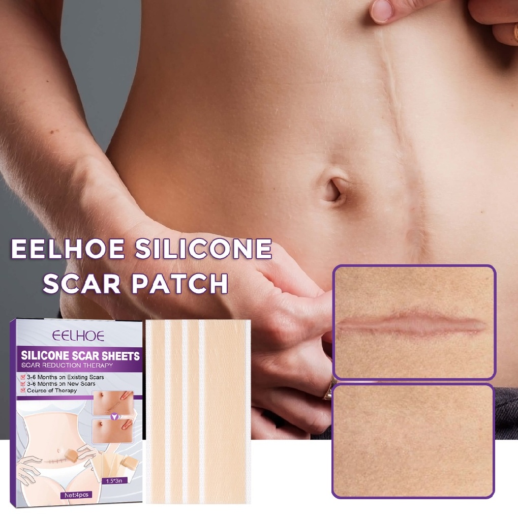 Silicone Scar Sheets Invisible Surgical Scar Removal Tape Scar Removal Treatment