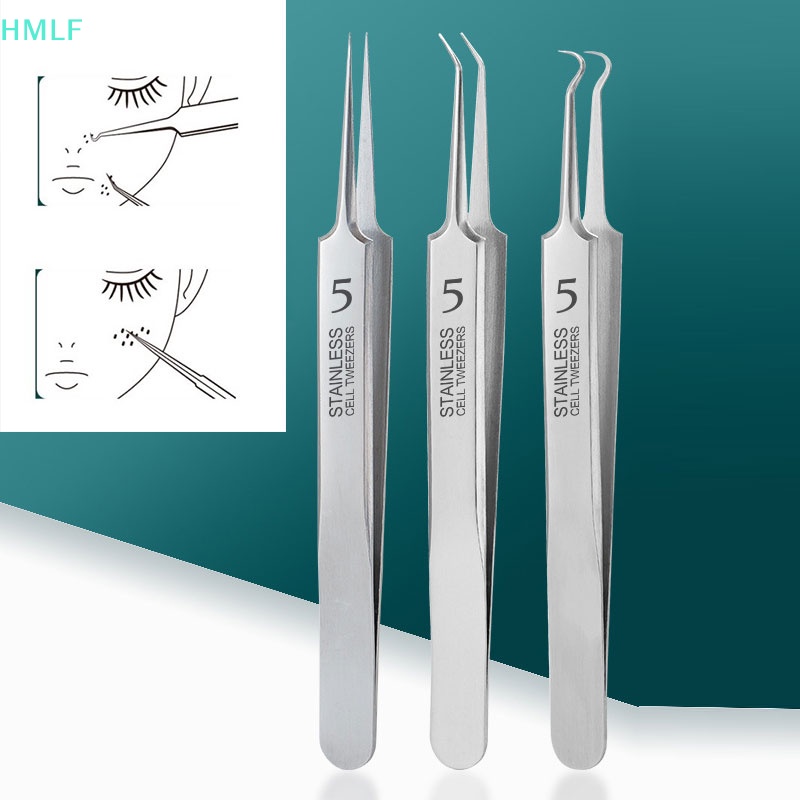 Nhíp Gắp Mụn Đầu Đen Chuyên Dụng Cho Salon Làm Đẹp