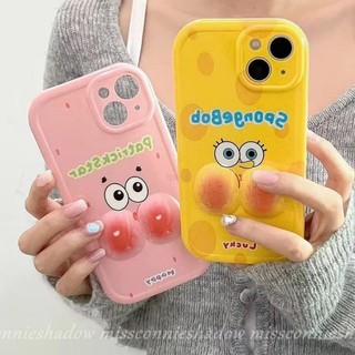 Ốp điện thoại MISSCONNIE hình SpongeBob mặt véo 3D thích hợp cho iphone 12 13 11 14 pro max xr 6s 7 6 8 plus x xs max se