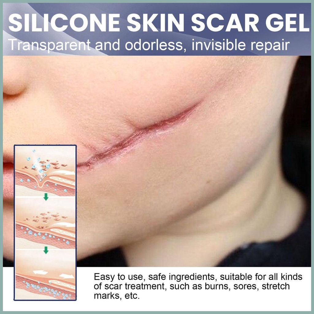 Bút xóa sẹo cầm tay bút tia uv máy chữa sẹo máy làm đẹp bút tẩy trang dụng cụ chăm sóc da cầm tay yunvn