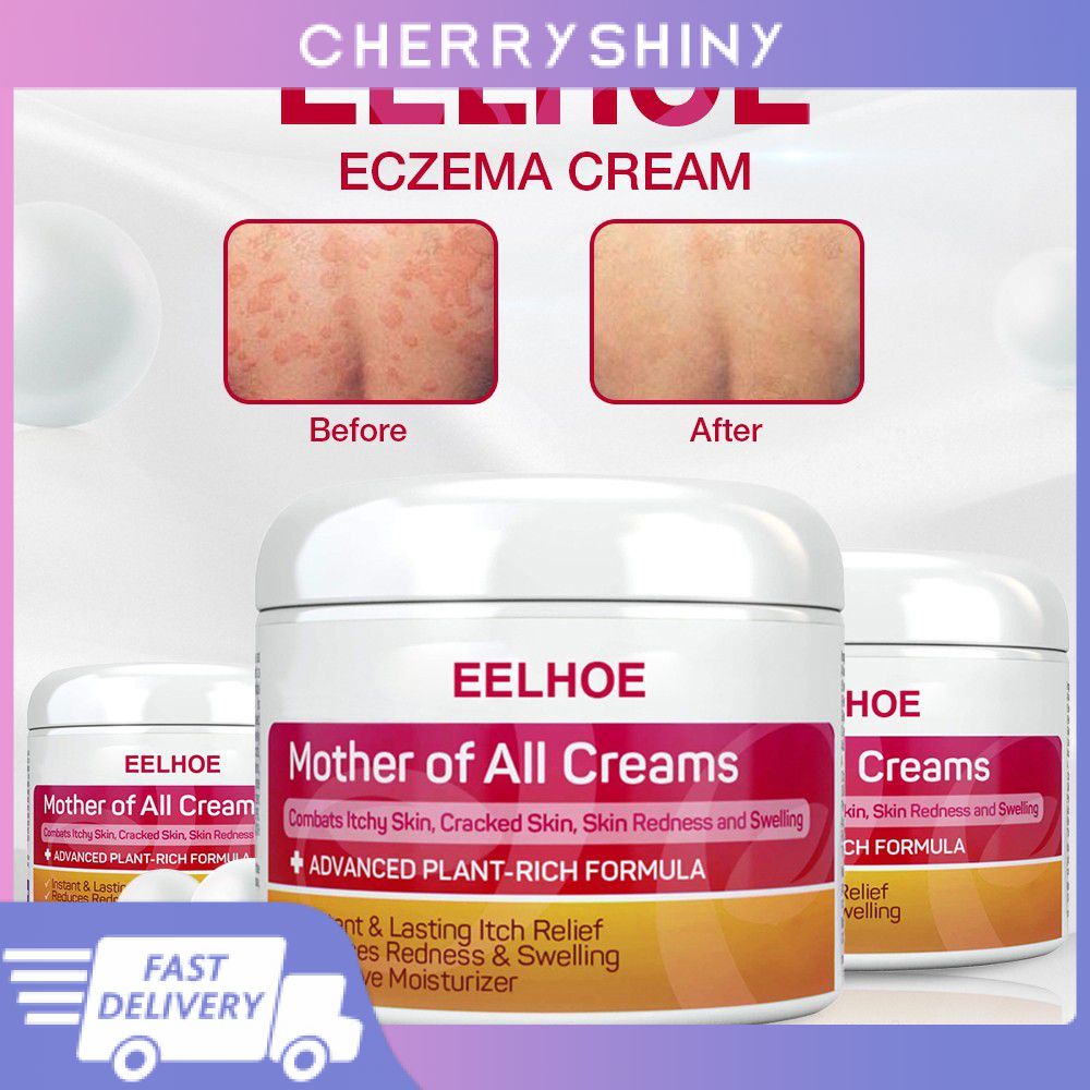 Nóng! Eelhoe Kem Bôi Vảy Nến Da   Mỡ Điều Trị Bệnh Chàm Da Viêm Da Eczema Kem Chăm Sóc Da Toàn Thân