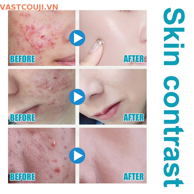 Khẩu Trang Chống Tia Uv Thoáng Khí Thoải Mái Phù Hợp Cho Mùa Hè