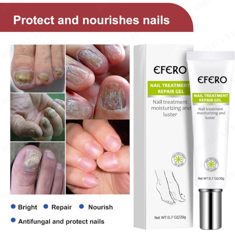 Gel Phục Hồi Móng Tay