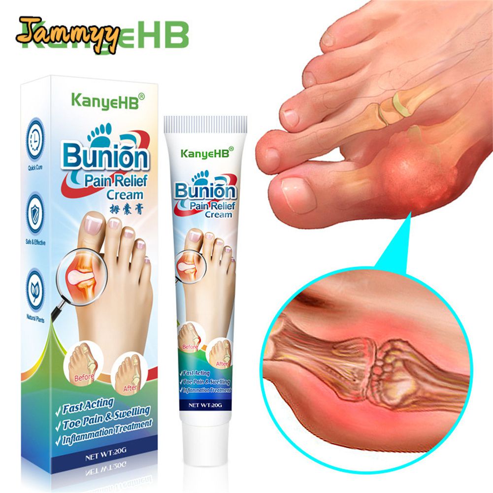 Jammy Kanyehb Bunion Kem Da Bôi Bunion Hallux Valgus Đau Gót Giảm Đau