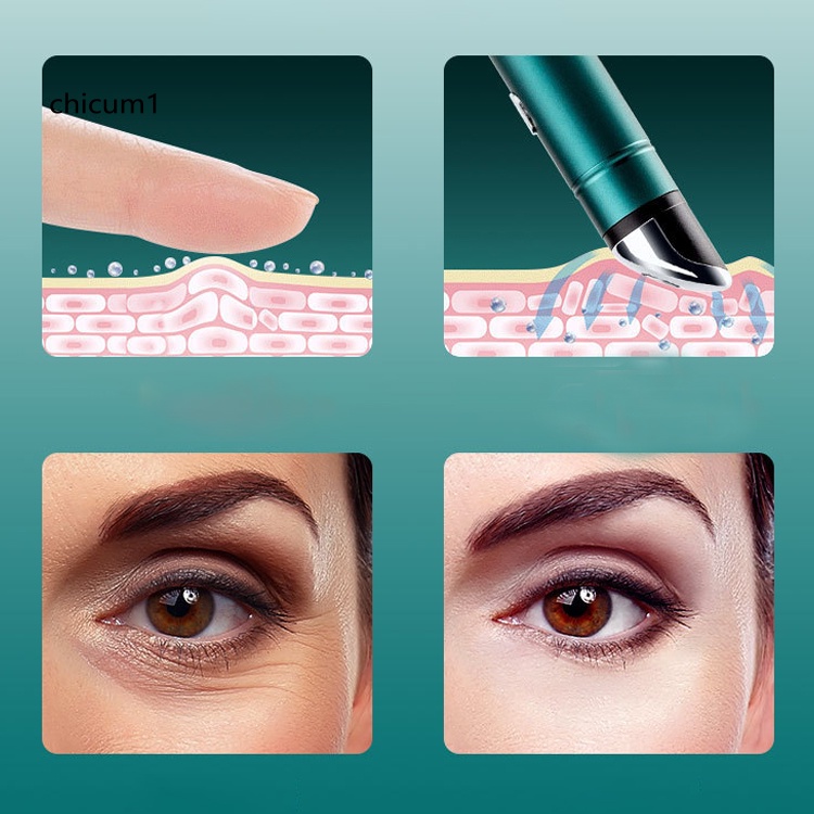 Cây Lăn Mát Xa Mắt Bằng ABS Thoải Mái Chống Nếp Nhăn Có Thể Sạc Lại Cho Phái