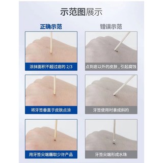 Bán Chạy#云南本草去志点痣膏无痕非药水祛药膏点斑去尤液无痛不留疤7. 16li