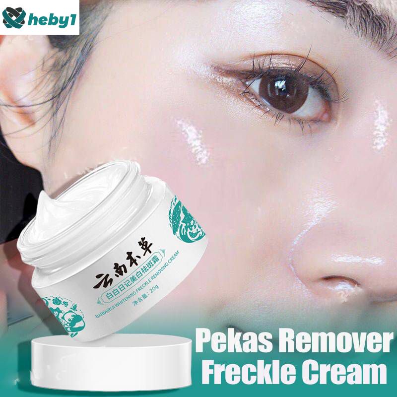 3 Kem Trị Nám Hiệu Quả Pekas Tẩy Da Mặt Loại Bỏ Vết Thâm Nám Làm Trắng Da Tàn Nhang Heby1