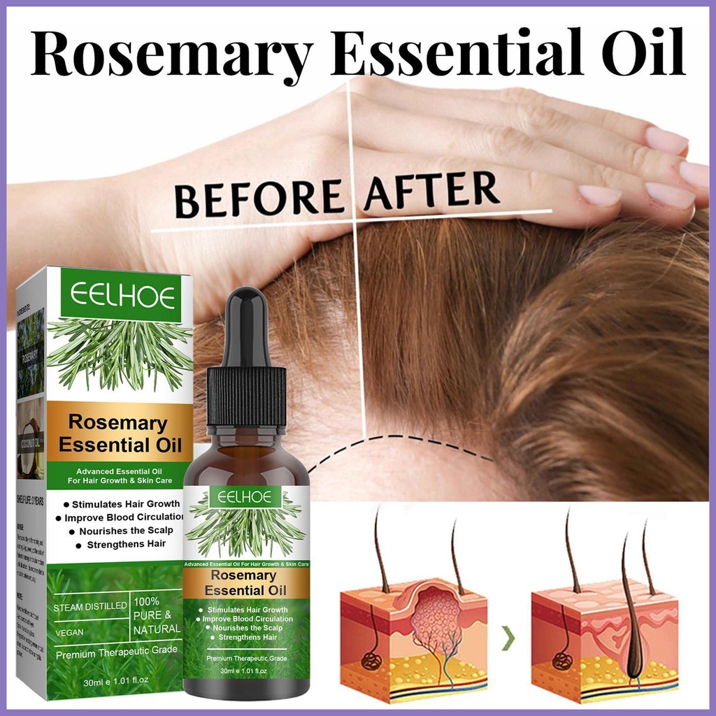 Tinh Chất Kích Thích Mọc Tóc 30ml Nuôi Dưỡng Da Đầu Và Tóc nota2vn