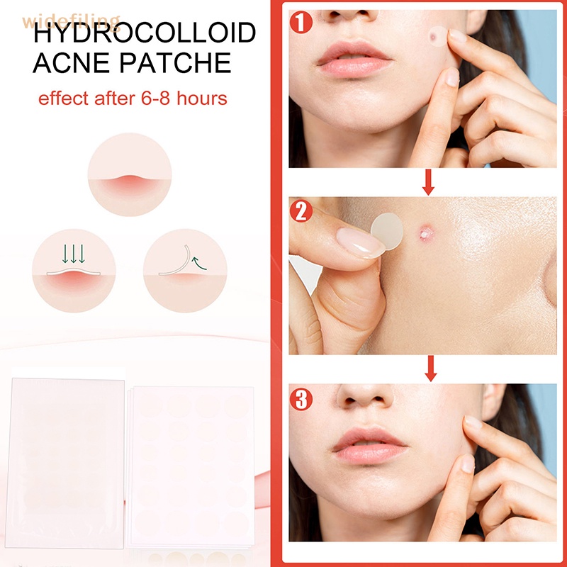 Bộ 24 Miếng Dán Hỗ trợ giảm mụn Chăm Sóc Da Mặt