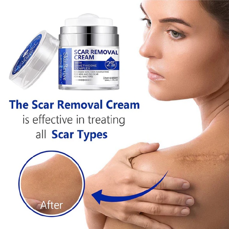 50ml Scar Removal Cream Skin Repair Body Acne Stretch Marks Remover Gel