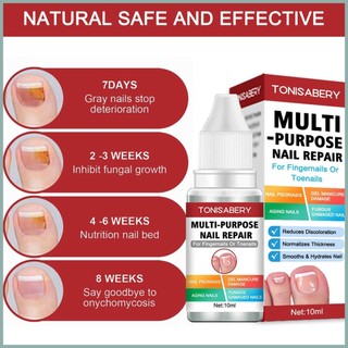 Tinh Chất Phục Hồi Móng Hư Tổn 10ml