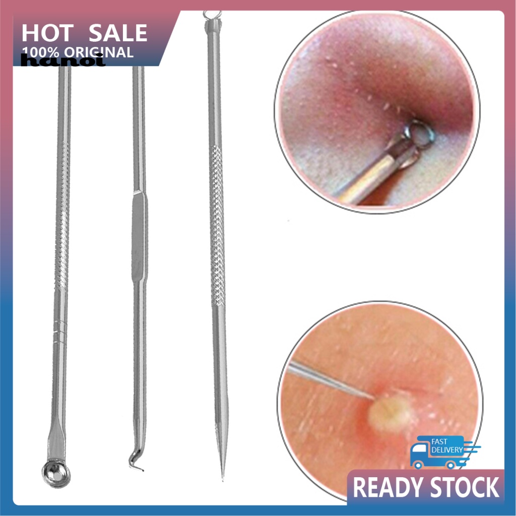 Set 3 Dụng Cụ Nặn Mụn Đầu Đen Bằng Thép Không Gỉ Tái Sử Dụng Linh Hoạt