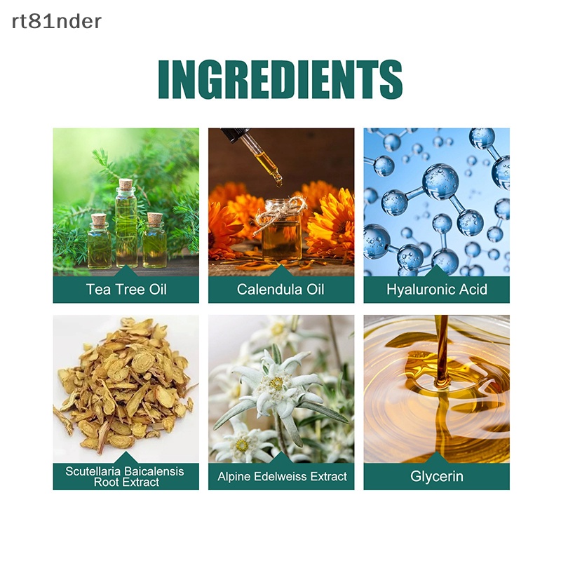 Bộ 112 Miếng Dán Loại Bỏ Mụn Nhiều Màu Sắc