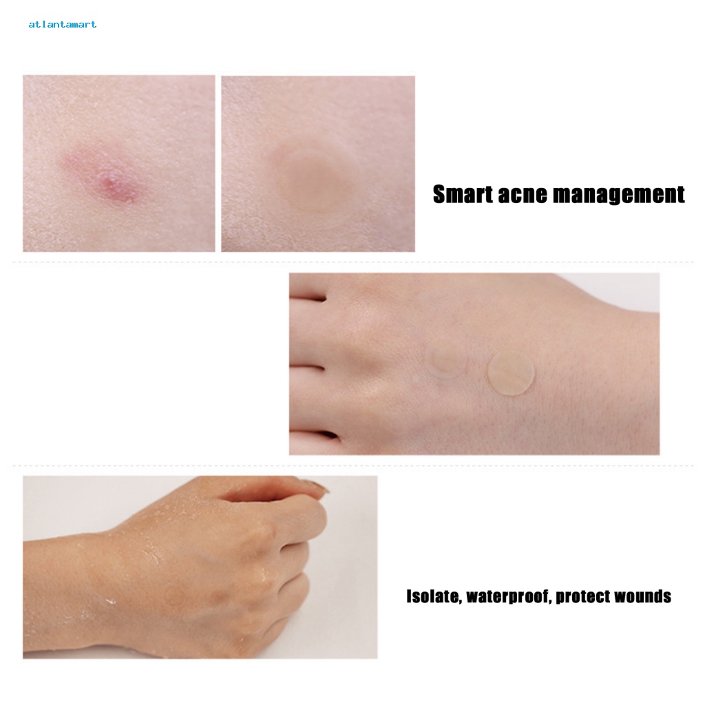 Túi Đựng Đồ Dùng Cao Cấp Tiện Dụng| Set 36 Miếng Dán Hỗ trợ giảm mụn Siêu Mỏng Chống Thấm Nước