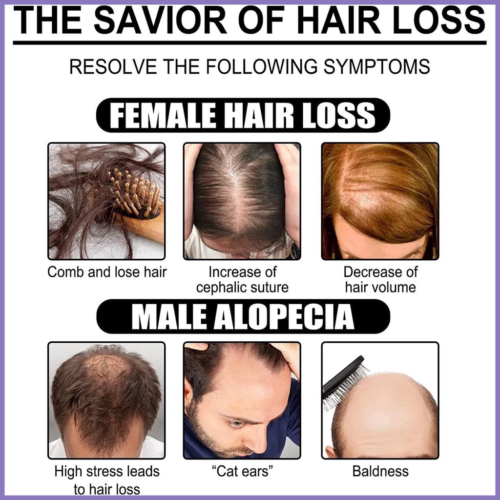 Tinh Chất Kích Thích Mọc Tóc Tái Tạo Tóc Dày Dặn 20ml nota2vn