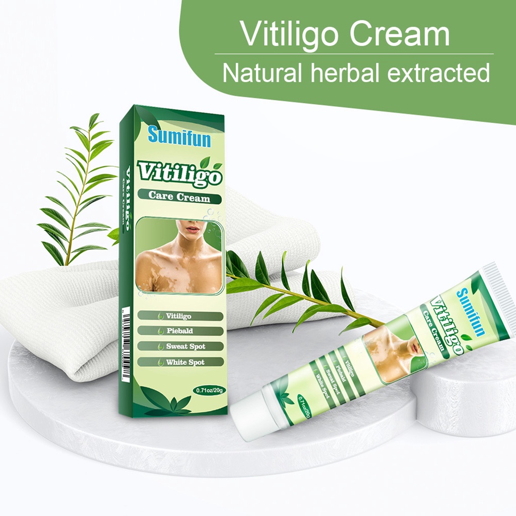 Kem Trị Vảy Nến Vitiligo 20g Hấp Thụ Nhanh Và Chống Ngứa