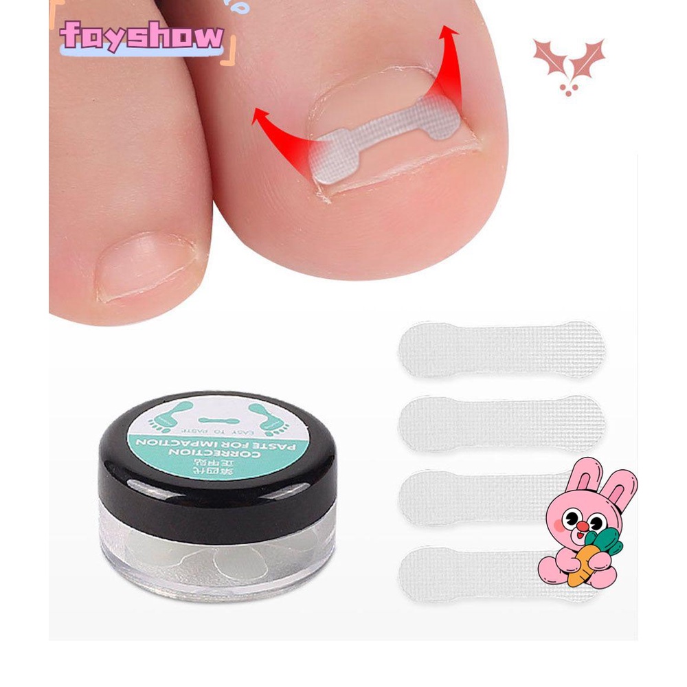 Set 10 Miếng Dán Chỉnh Sửa Tư Thế Chăm Sóc Móng Chân DIY Tiện Dụng