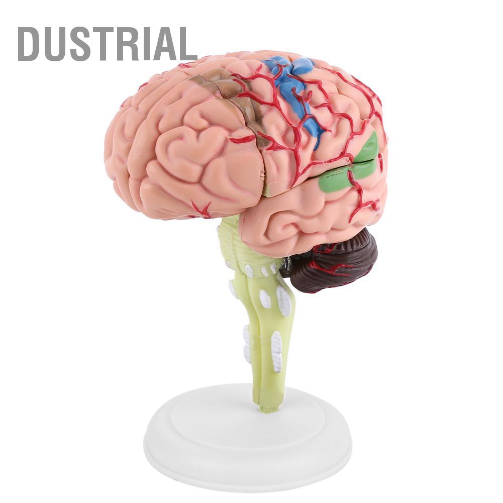 Dustrial 1 Máy Tính Tháo Rời Giải Phẫu Bộ Não Con Người Mô Hình Y Tế Dụng Cụ Giảng Dạy Đồ Chơi