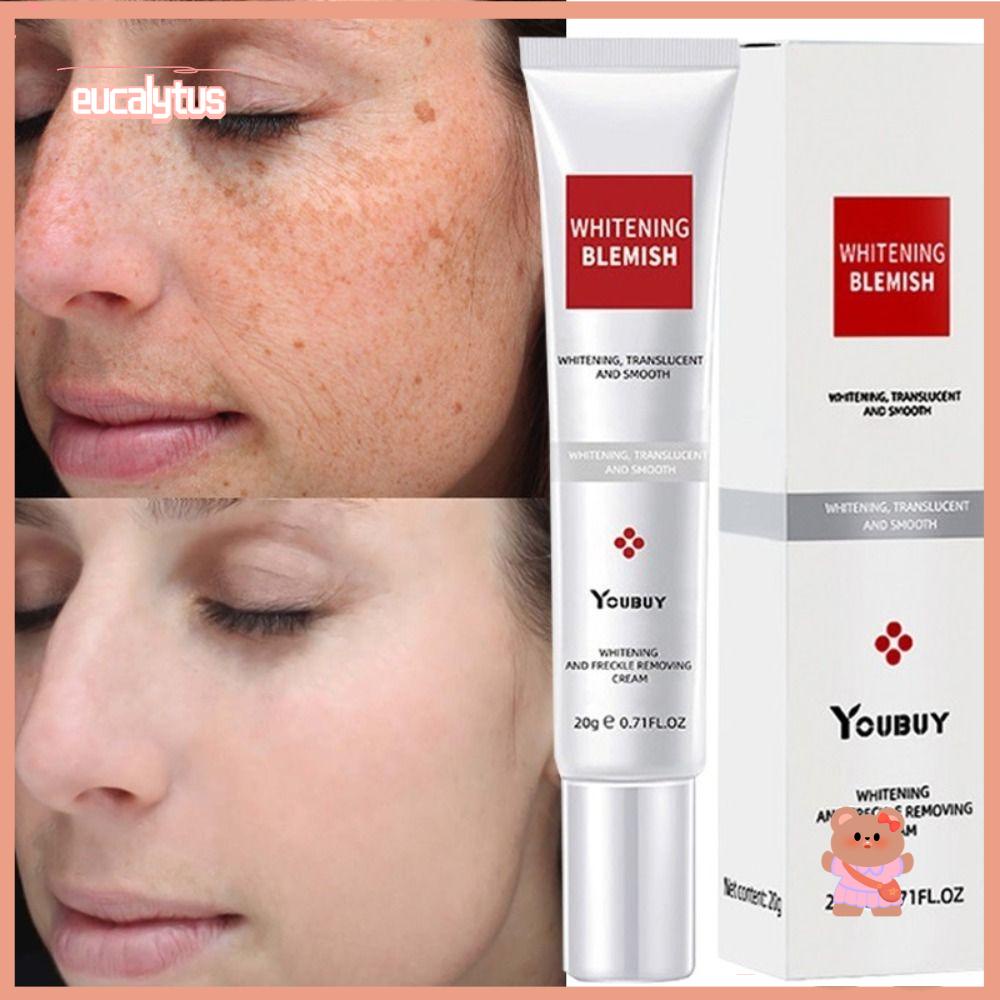 EUTUS Kem Hỗ trợ giảm tàn nhang Làm Trắng Da Và Chống Lão Hóa Hiệu Quả