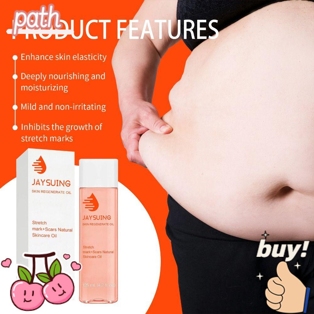 Kem Hỗ Trợ Giảm Sẹo Và Rạn Da Cho Phụ Nữ Mang Thai