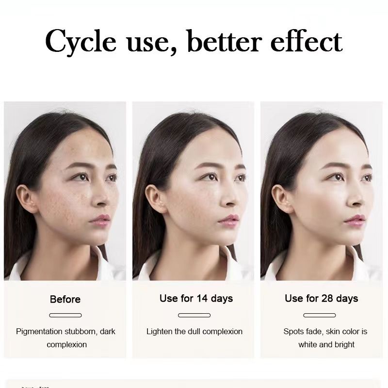 Serum HOUMAI 50ml Làm Trắng Xóa Tàn Nhang Và Chống Lão Hóa Da