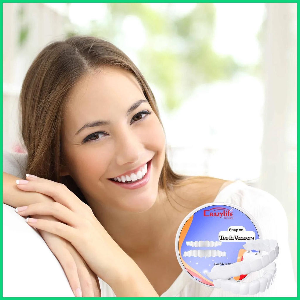 Răng Giả Veneers Snap on Snap on Teeth Veneers Che Phủ Răng Giả Imperfect