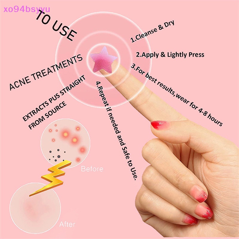 Set 126 Miếng Dán Mụn Vô Hình Xo94Bsyu