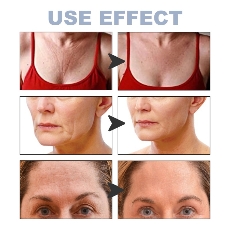 Miếng Dán Làm Săn Chắc Da Chống Lão Hóa Và Nếp Nhăn Dành Cho Vùng Trán YOUYO