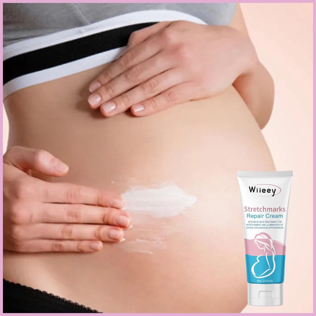 Kem Hỗ trợ giảm rạn da / Sẹo Phục Hồi Làn Da Cho Mẹ Và Bạn Sử Dụng Rộng Trong shinvn