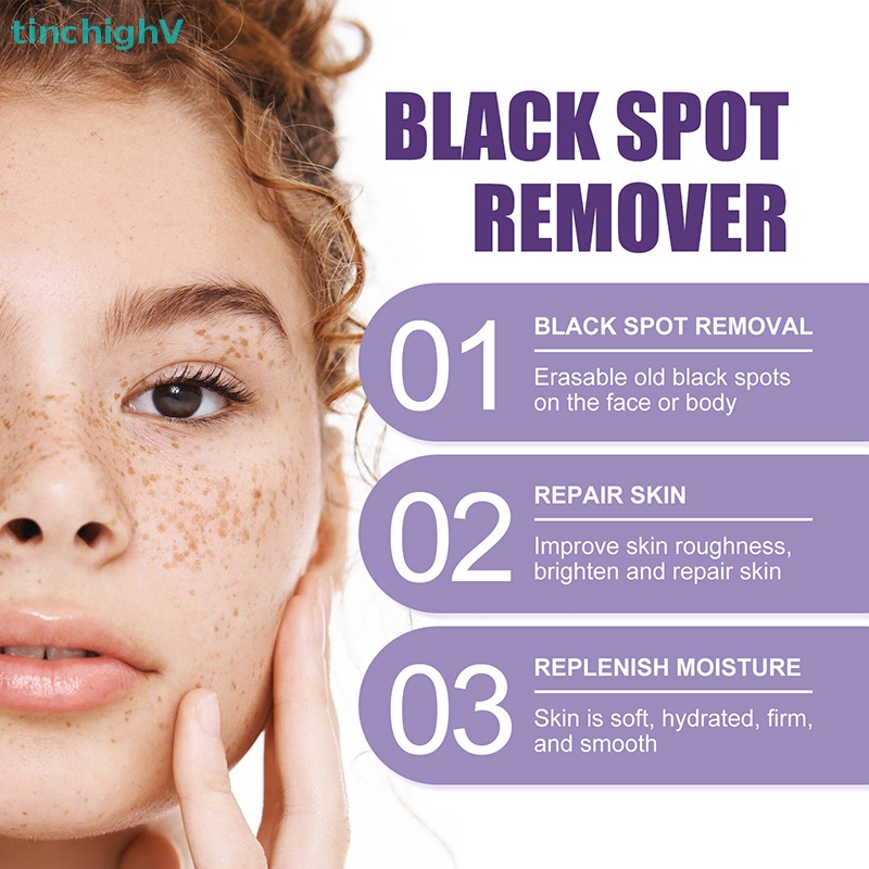 Thanh Lăn Loại Bỏ Đốm Đen Làm Sáng Da Mặt 10ml