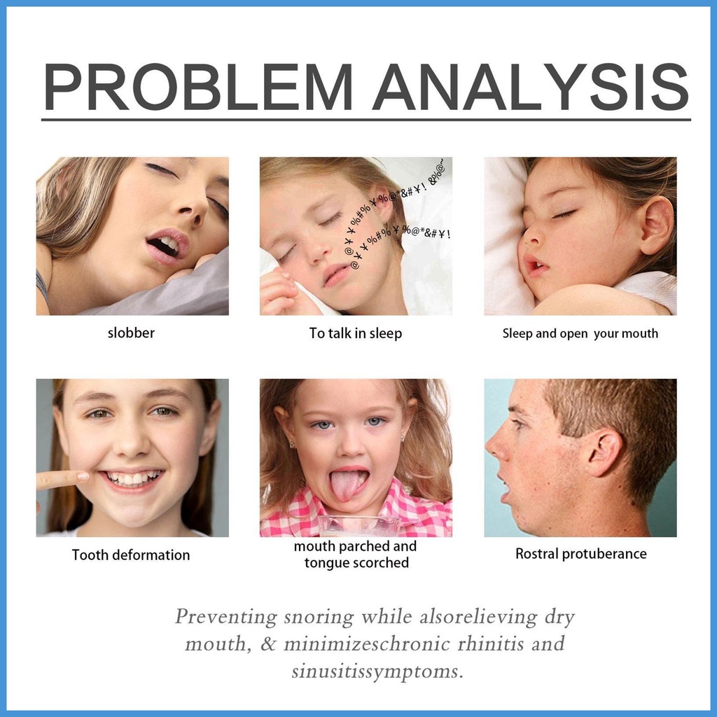 Dung Dịch Chống Ngáy Tự Nhiên 30ML An Toàn Tiện Dụng