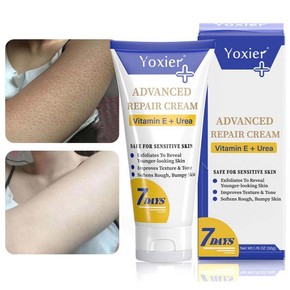 Yoxier Advanced Moisturizing Repair Cream deeply moisturizes the skin and treats itching keratosis