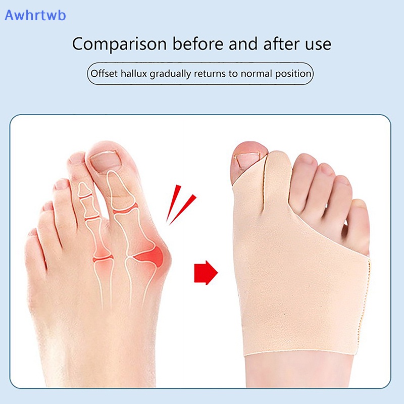 1 Cặp Dụng Cụ Chỉnh Hình Ngón Chân Cái Mới