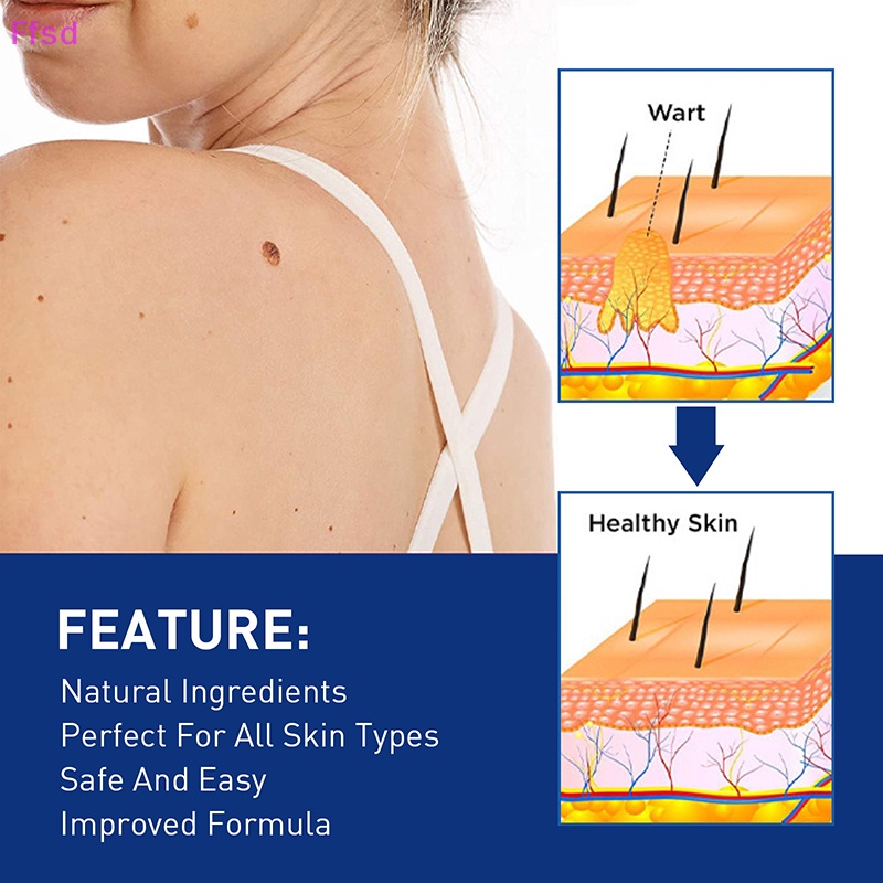 1 Dụng Cụ Kẹp Nhỏ Bằng Đồng Loại Bỏ Mụn Thịt Xăm Hình