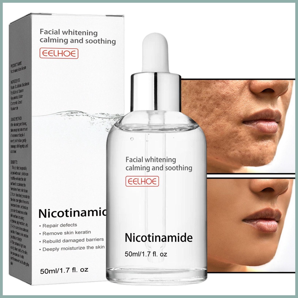 Tinh Chất Niacinamide Dưỡng Ẩm Chăm Sóc Da Mặt Hàng Ngày Cho Làn Da Rạng Rỡ Và Săn Chắc Hơn